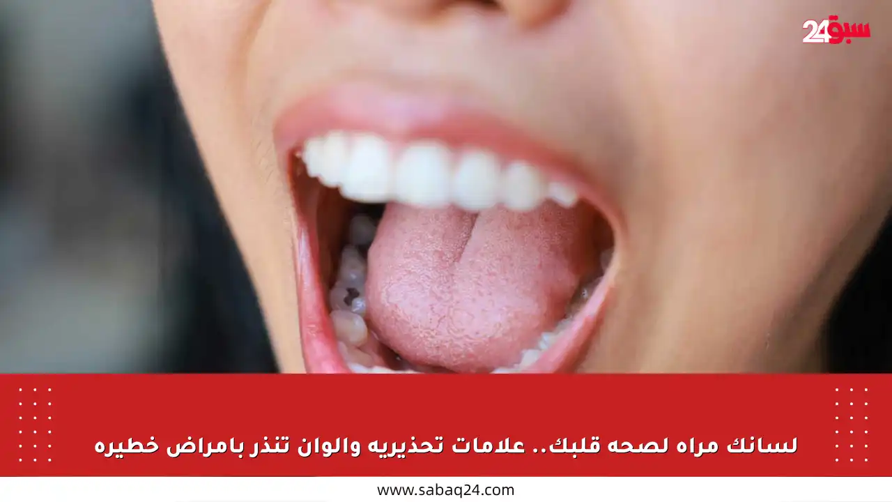 لسانك مرآة لصحة قلبك.. علامات تحذيرية وألوان تنذر بأمراض خطيرة